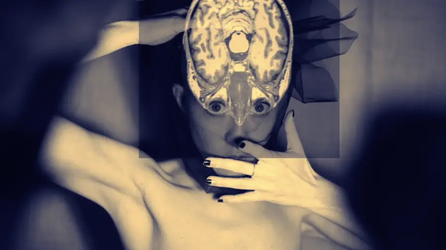 Photo en noir et blanc d'une femme avec les mains autour de sa tête, l'image d'une radiographie du cerveau superposé à son visage